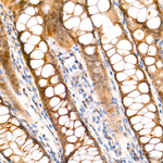 HIF1AN Antibody in Immunohistochemistry (Paraffin) (IHC (P))