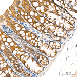 HIF1AN Antibody in Immunohistochemistry (Paraffin) (IHC (P))