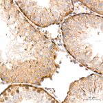 HIF1AN Antibody in Immunohistochemistry (Paraffin) (IHC (P))