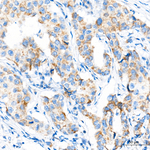 C14orf159 Recombinant Rabbit Monoclonal Antibody (10Y4K5)