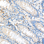 C14orf159 Antibody in Immunohistochemistry (Paraffin) (IHC (P))