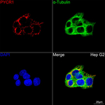 PYCR1 Recombinant Rabbit Monoclonal Antibody (5X6X1)