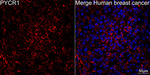PYCR1 Antibody in Immunohistochemistry (Paraffin) (IHC (P))