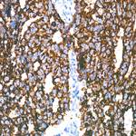 PYCR1 Antibody in Immunohistochemistry (Paraffin) (IHC (P))