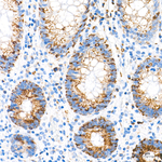 PYCR1 Antibody in Immunohistochemistry (Paraffin) (IHC (P))