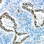 PYCR1 Antibody in Immunohistochemistry (Paraffin) (IHC (P))