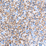 PYCR1 Antibody in Immunohistochemistry (Paraffin) (IHC (P))