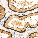 TOMM34 Recombinant Rabbit Monoclonal Antibody (9W7X3)