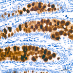 MUC2 Antibody in Immunohistochemistry (Paraffin) (IHC (P))