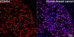 KDM6A Recombinant Rabbit Monoclonal Antibody (9A5R2)