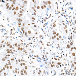 KDM6A Antibody in Immunohistochemistry (Paraffin) (IHC (P))