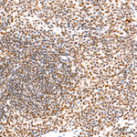 KDM6A Antibody in Immunohistochemistry (Paraffin) (IHC (P))
