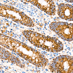 ROMO1 Antibody in Immunohistochemistry (Paraffin) (IHC (P))