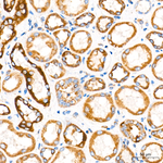 ROMO1 Antibody in Immunohistochemistry (Paraffin) (IHC (P))