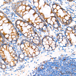 ROMO1 Antibody in Immunohistochemistry (Paraffin) (IHC (P))
