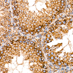 ROMO1 Antibody in Immunohistochemistry (Paraffin) (IHC (P))