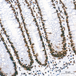FOXK1 Antibody in Immunohistochemistry (Paraffin) (IHC (P))
