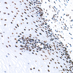 FOXK1 Antibody in Immunohistochemistry (Paraffin) (IHC (P))