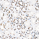 FOXK1 Antibody in Immunohistochemistry (Paraffin) (IHC (P))