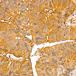LDHB Antibody in Immunohistochemistry (Paraffin) (IHC (P))