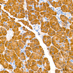 LDHB Antibody in Immunohistochemistry (Paraffin) (IHC (P))