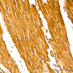 LDHB Antibody in Immunohistochemistry (Paraffin) (IHC (P))