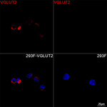 VGLUT2 Recombinant Rabbit Monoclonal Antibody (5C4B2)