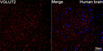 VGLUT2 Antibody in Immunohistochemistry (Paraffin) (IHC (P))