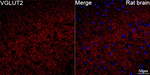 VGLUT2 Antibody in Immunohistochemistry (Paraffin) (IHC (P))
