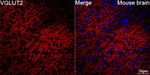 VGLUT2 Antibody in Immunohistochemistry (Paraffin) (IHC (P))