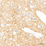 VGLUT2 Antibody in Immunohistochemistry (Paraffin) (IHC (P))
