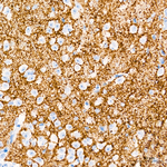 VGLUT2 Antibody in Immunohistochemistry (Paraffin) (IHC (P))