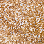 VGLUT2 Antibody in Immunohistochemistry (Paraffin) (IHC (P))