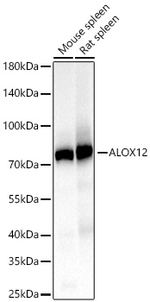 ALOX12 Antibody in Western Blot (WB)
