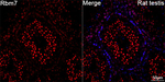 RBM7 Antibody in Immunohistochemistry (Paraffin) (IHC (P))