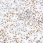 RBM7 Antibody in Immunohistochemistry (Paraffin) (IHC (P))