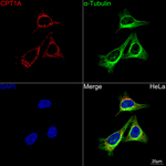 CPT1A Antibody in Immunocytochemistry (ICC/IF)