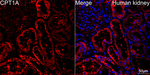 CPT1A Antibody in Immunohistochemistry (Paraffin) (IHC (P))