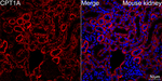 CPT1A Antibody in Immunohistochemistry (Paraffin) (IHC (P))