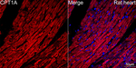 CPT1A Antibody in Immunohistochemistry (Paraffin) (IHC (P))