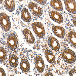 CPT1A Antibody in Immunohistochemistry (Paraffin) (IHC (P))