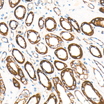 CPT1A Antibody in Immunohistochemistry (Paraffin) (IHC (P))
