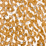 CPT1A Antibody in Immunohistochemistry (Paraffin) (IHC (P))