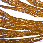CPT1A Antibody in Immunohistochemistry (Paraffin) (IHC (P))