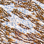 CPT1A Antibody in Immunohistochemistry (Paraffin) (IHC (P))