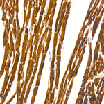 CPT1A Antibody in Immunohistochemistry (Paraffin) (IHC (P))