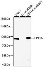 CPT1A Antibody in Immunoprecipitation (IP)