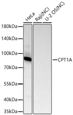 CPT1A Antibody in Western Blot (WB)