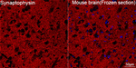 Synaptophysin Antibody in Immunohistochemistry (Frozen) (IHC (F))
