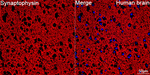 Synaptophysin Antibody in Immunohistochemistry (Paraffin) (IHC (P))